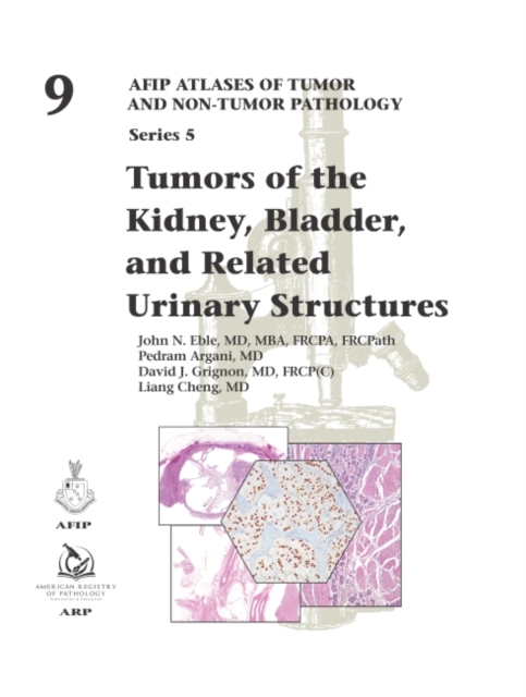 Tumors of the Kidney, Bladder, and Related Urinary Structures, Hardback Book