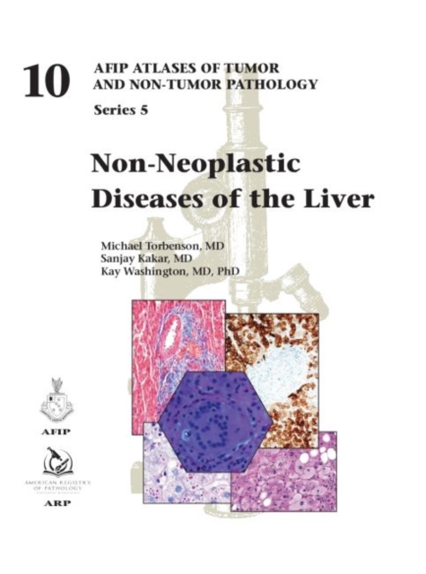 Non-Neoplastic Diseases of the Liver, Hardback Book