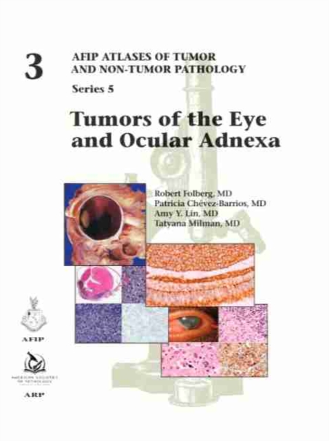 Tumors of the Eye and Ocular Adnexa, Hardback Book