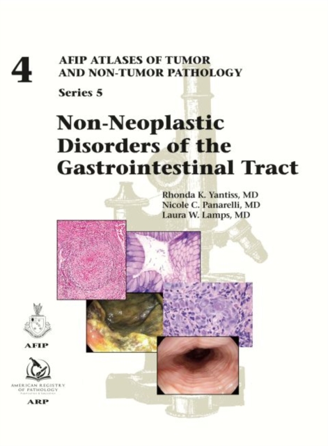 Non-Neoplastic Disorders of the Gastrointestinal Tract, Hardback Book