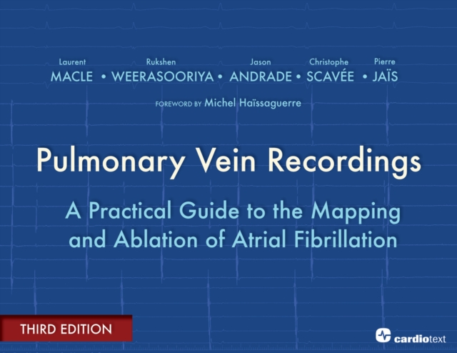 Pulmonary Vein Recordings : A Practical Guide to the Mapping and Ablation of Atrial Fibrillation, PDF eBook