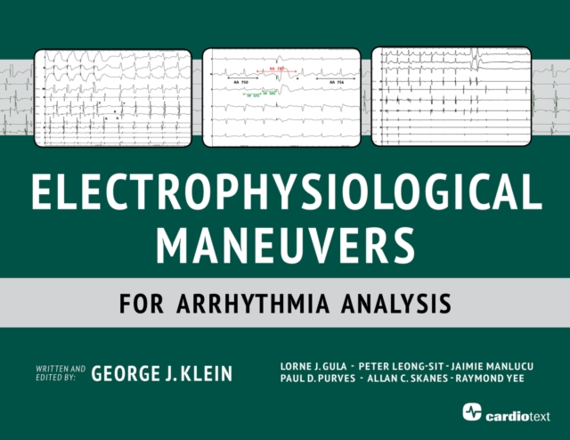 Electrophysiological Maneuvers for Arrhythmia Analysis, PDF eBook