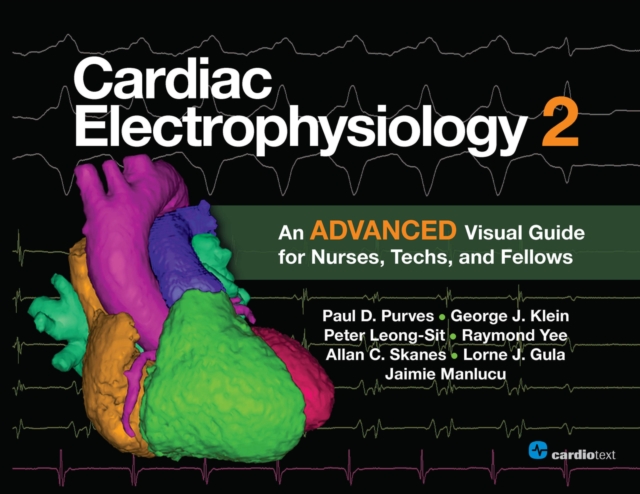 Cardiac Electrophysiology 2 : An Advanced Visual Guide for Nurses, Techs, and Fellows, PDF eBook