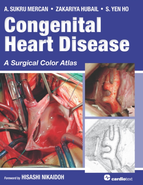 Congenital Heart Disease : A Surgical Color Atlas, PDF eBook