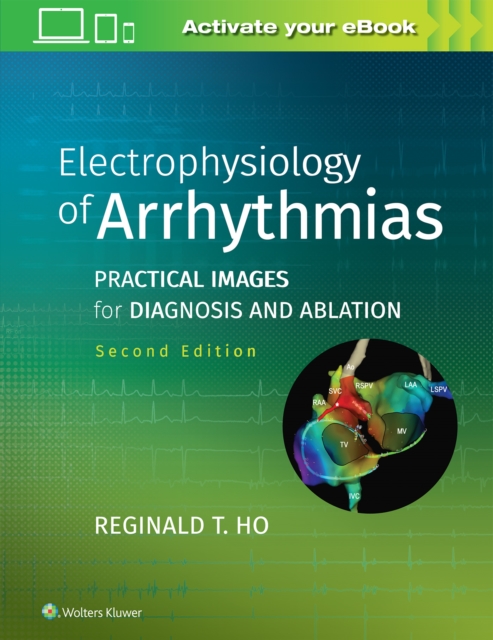 Electrophysiology of Arrhythmias : Practical Images for Diagnosis and Ablation, Hardback Book