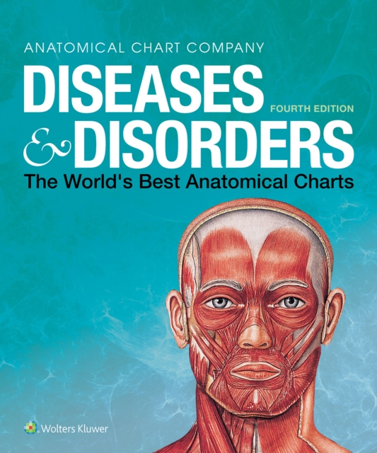 Diseases & Disorders : The World's Best Anatomical Charts, Spiral bound Book