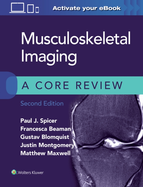 Musculoskeletal Imaging: A Core Review, Paperback / softback Book