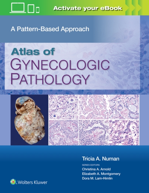 Atlas of Gynecologic Pathology : A Pattern-Based Approach: Print + eBook with Multimedia, Hardback Book