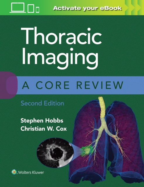 Thoracic Imaging: A Core Review, Paperback / softback Book