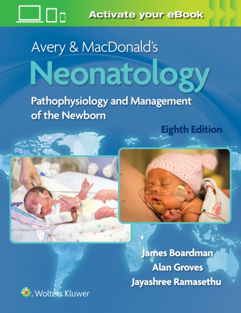 Avery & MacDonald's Neonatology : Pathophysiology and Management of the Newborn, Hardback Book