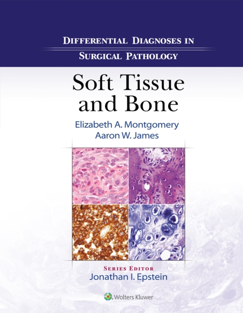Differential Diagnoses in Surgical Pathology: Soft Tissue and Bone, EPUB eBook