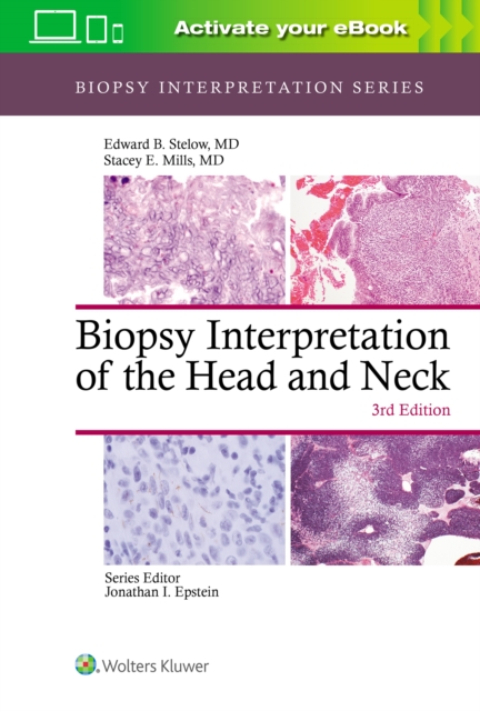 Biopsy Interpretation of the Head and Neck, Hardback Book