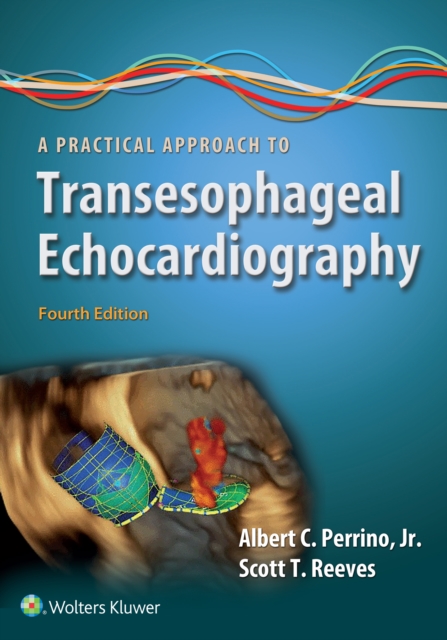 A Practical Approach to Transesophageal Echocardiography, EPUB eBook