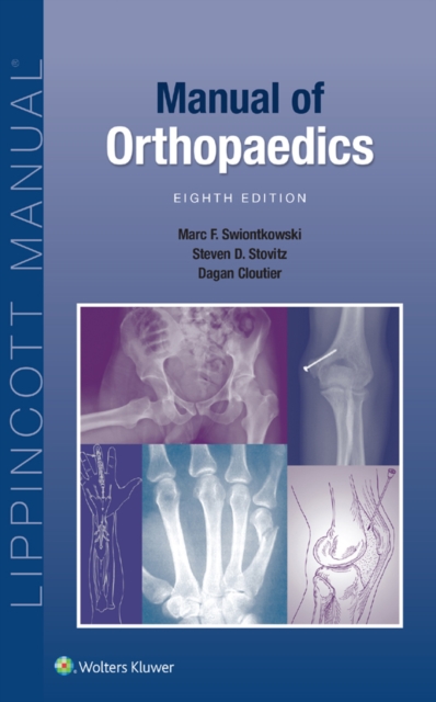 Manual of Orthopaedics, EPUB eBook