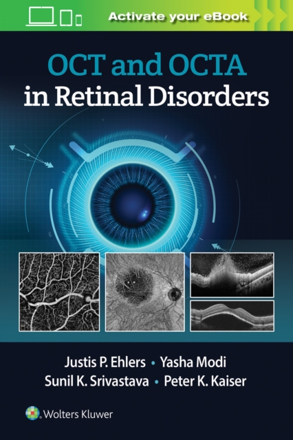 OCT and OCTA in Retinal Disorders, Paperback / softback Book