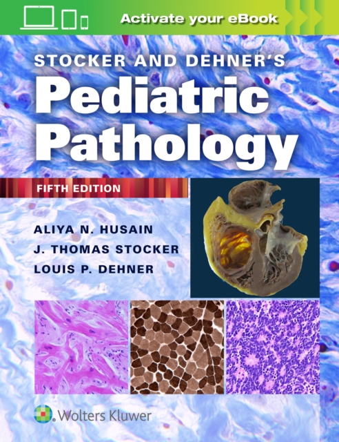 Stocker and Dehner's Pediatric Pathology, Hardback Book