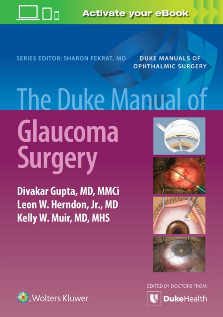 The Duke Manual of Glaucoma Surgery, Paperback / softback Book