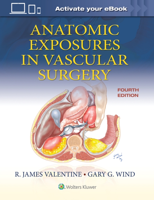 Anatomic Exposures in Vascular Surgery, Hardback Book