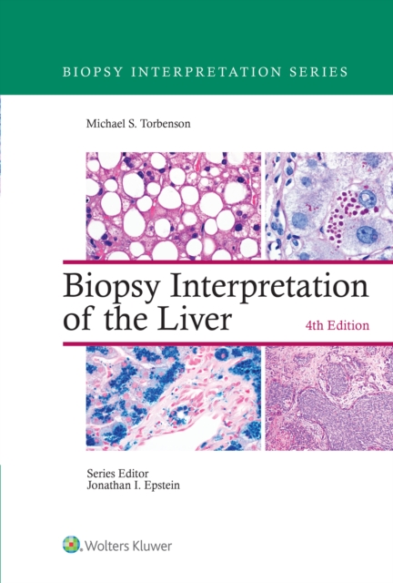 Biopsy Interpretation of the Liver, EPUB eBook