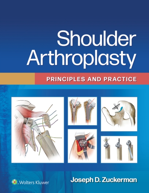 Shoulder Arthroplasty, EPUB eBook