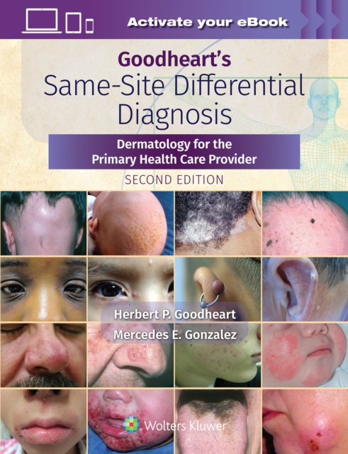 Goodheart's Same-Site Differential Diagnosis : Dermatology for the Primary Health Care Provider, Hardback Book