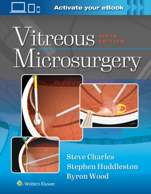Vitreous Microsurgery, Hardback Book