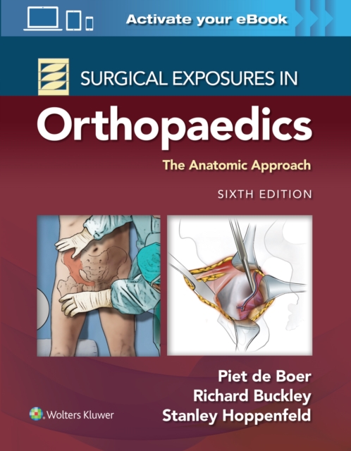 Surgical Exposures in Orthopaedics: The Anatomic Approach, Hardback Book