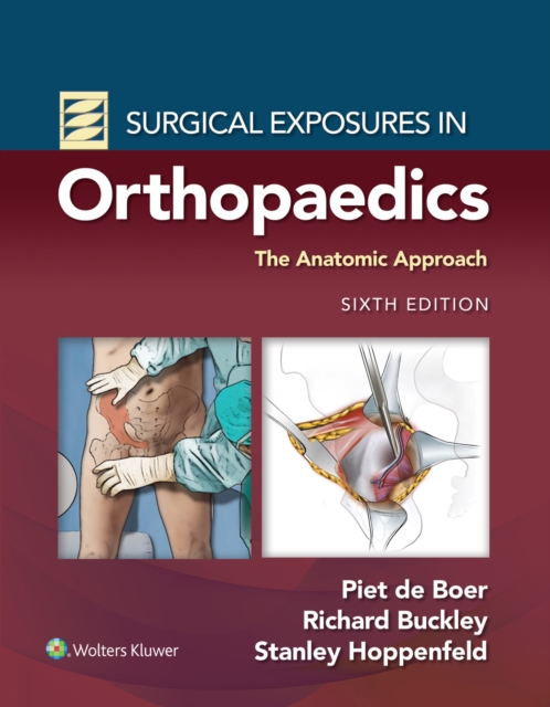 Surgical Exposures in Orthopaedics: The Anatomic Approach, EPUB eBook