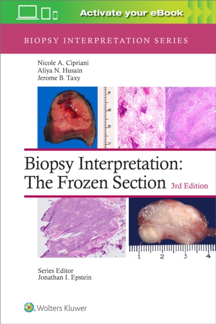 Biopsy Interpretation: The Frozen Section, Hardback Book