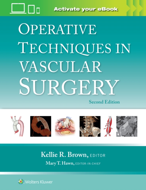 Operative Techniques in Vascular Surgery, Hardback Book
