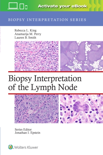 Biopsy Interpretation of the Lymph Node, Hardback Book