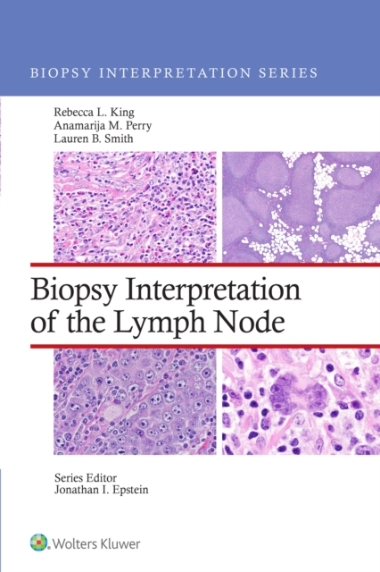 Biopsy Interpretation of the Lymph Nodes, EPUB eBook