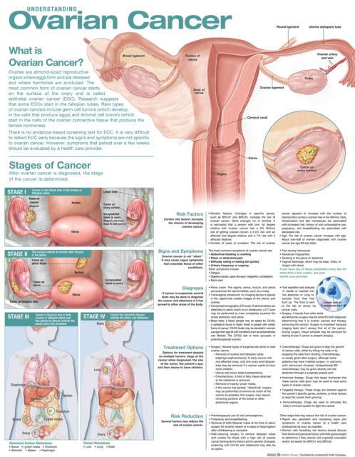 Understanding Ovarian Cancer Anatomical Chart, Wallchart Book