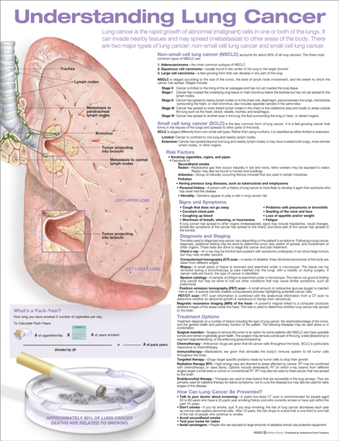 Understanding Lung Cancer Anatomical Chart, Wallchart Book