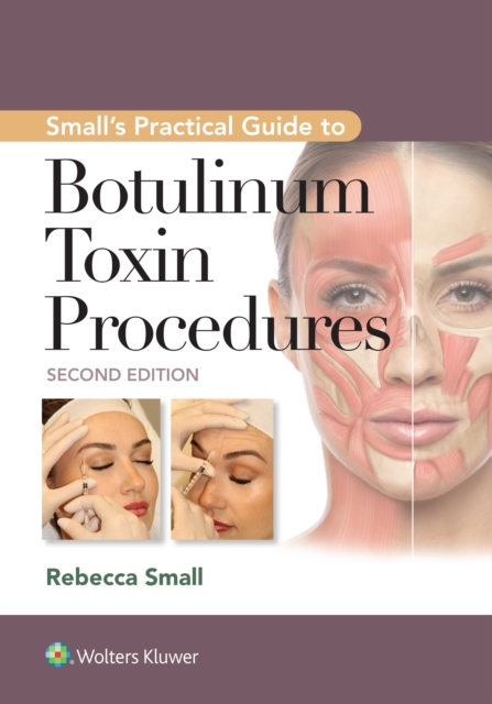 Small's Practical Guide to Botulinum Toxin Procedures, EPUB eBook