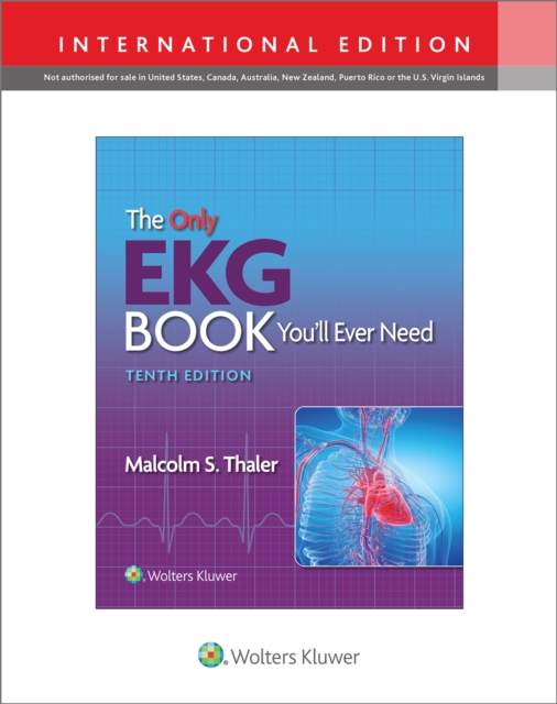 The Only EKG Book You'll Ever Need, Paperback / softback Book