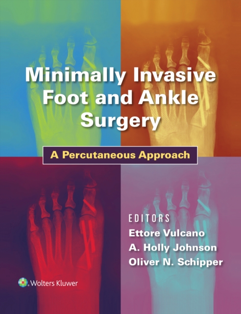 Minimally Invasive Foot and Ankle Surgery : A Percutaneous Approach, EPUB eBook