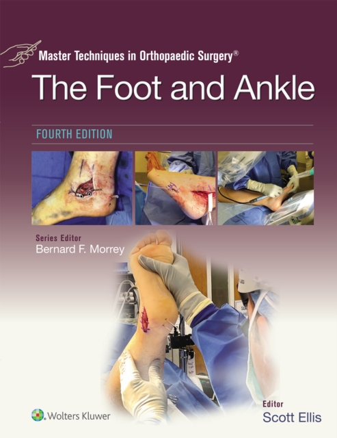 Master Techniques in Orthopaedic Surgery: The Foot and Ankle, EPUB eBook