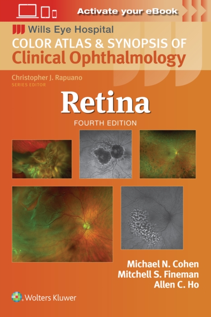 Retina, Paperback / softback Book