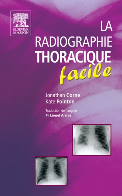 La radiographie thoracique facile, EPUB eBook
