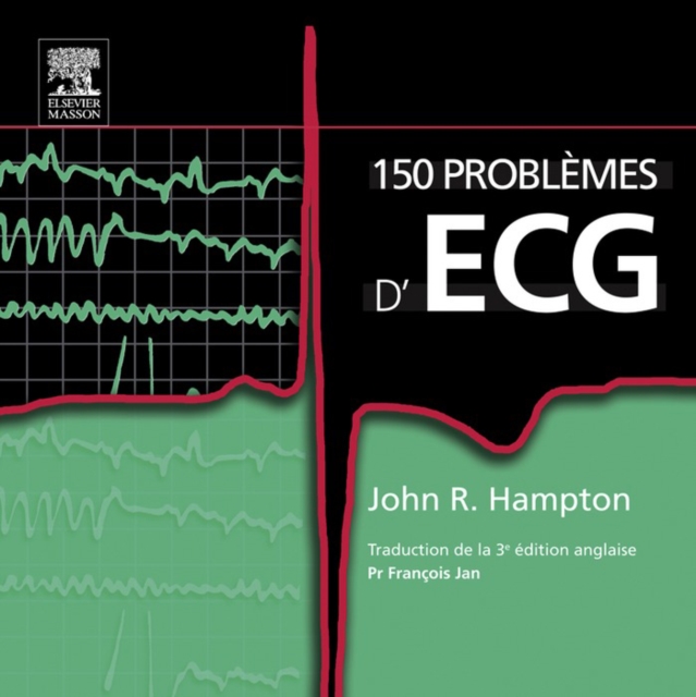 150 problemes d'ECG, EPUB eBook
