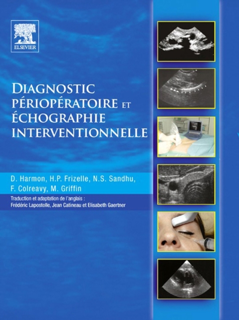 Diagnostic perioperatoire et echographie interventionnelle : avec DVD en anglais, EPUB eBook