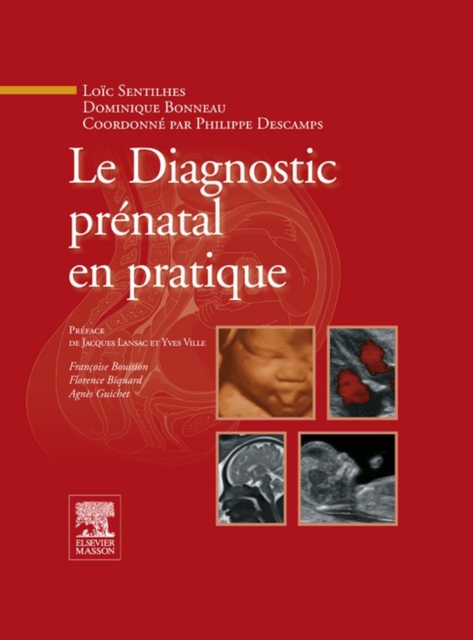 Le Diagnostic prenatal en pratique, EPUB eBook
