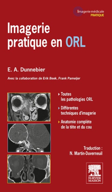 Imagerie pratique en ORL, EPUB eBook