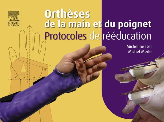 Ortheses de la main et du poignet. Protocoles de reeducation, EPUB eBook