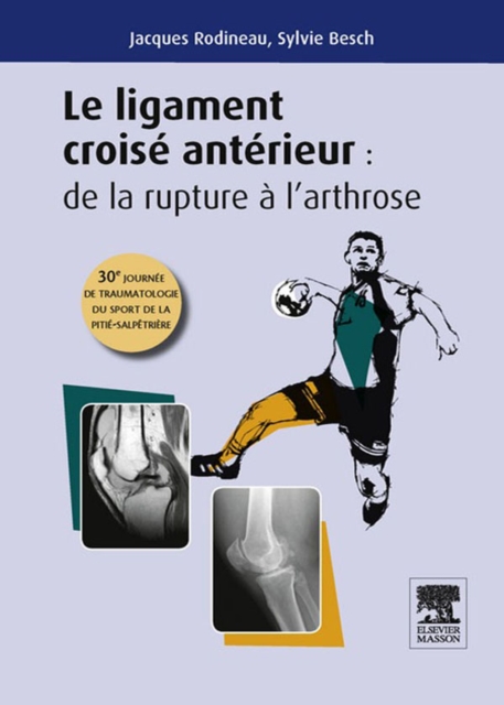 Le ligament croise anterieur : de la rupture a l'arthrose : 30e journee de traumatologie du sport de la Pitie, EPUB eBook