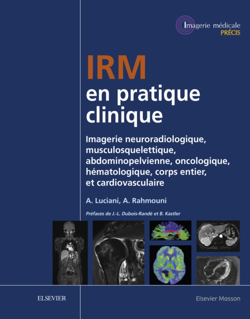 IRM en pratique clinique : Imagerie neuroradiologique, musculosquelettique, abdominopelvienne, oncologique, hematologique, corps entier, et cardiovasculaire, EPUB eBook