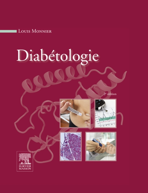 Diabetologie, EPUB eBook