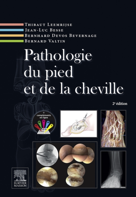 Pathologie du pied et de la cheville, EPUB eBook