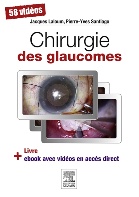 Chirurgie des glaucomes, EPUB eBook